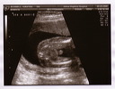 Baby Preston sonogram