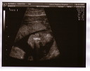 baby_sono_face_5_25_06