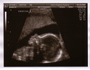 baby_sono_profile_5_25_06