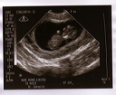 baby_sonogram_1c