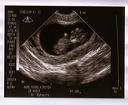baby_sonogram_1d