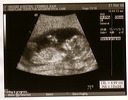 baby_sonogram_2_27_06