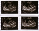 baby_sonogram_4x