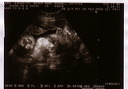 sonogram_8_16_06-3