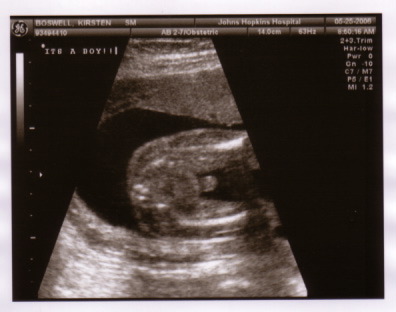 baby_sono_boy_5_25_06.jpg